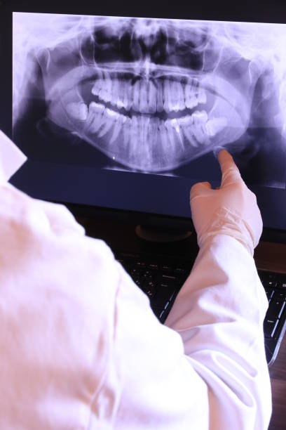 Best Emergency Root Canal Treatment in Fletcher, OK