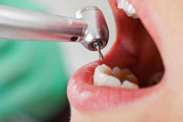 Best Emergency Broken Tooth Repair in Fletcher, OK